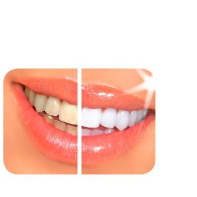 Davinci Laser Teeth Whitening Logo