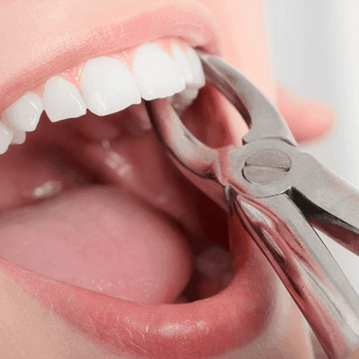 Product: Extractions – Envisage Dental | Dentists in Sunnybank, Upper Mount Gravatt