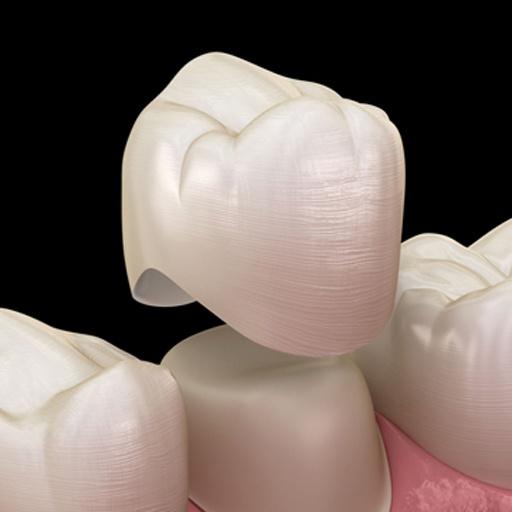 Product: Crowns – Envisage Dental | Dentists in Sunnybank, Upper Mount Gravatt