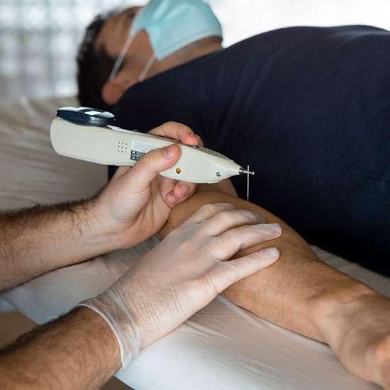 Product Dry Needling in Edmonton | Innovation Physical Therapy image