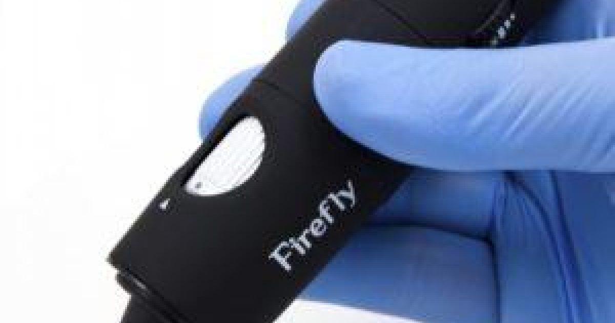 Product Firefly USB Otoscope image