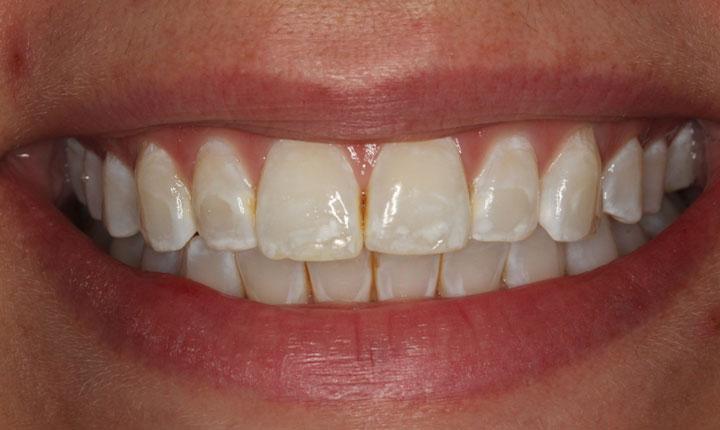 Product: Shine Modern Dentistry - Cosmetic Dentistry | Joplin, MO