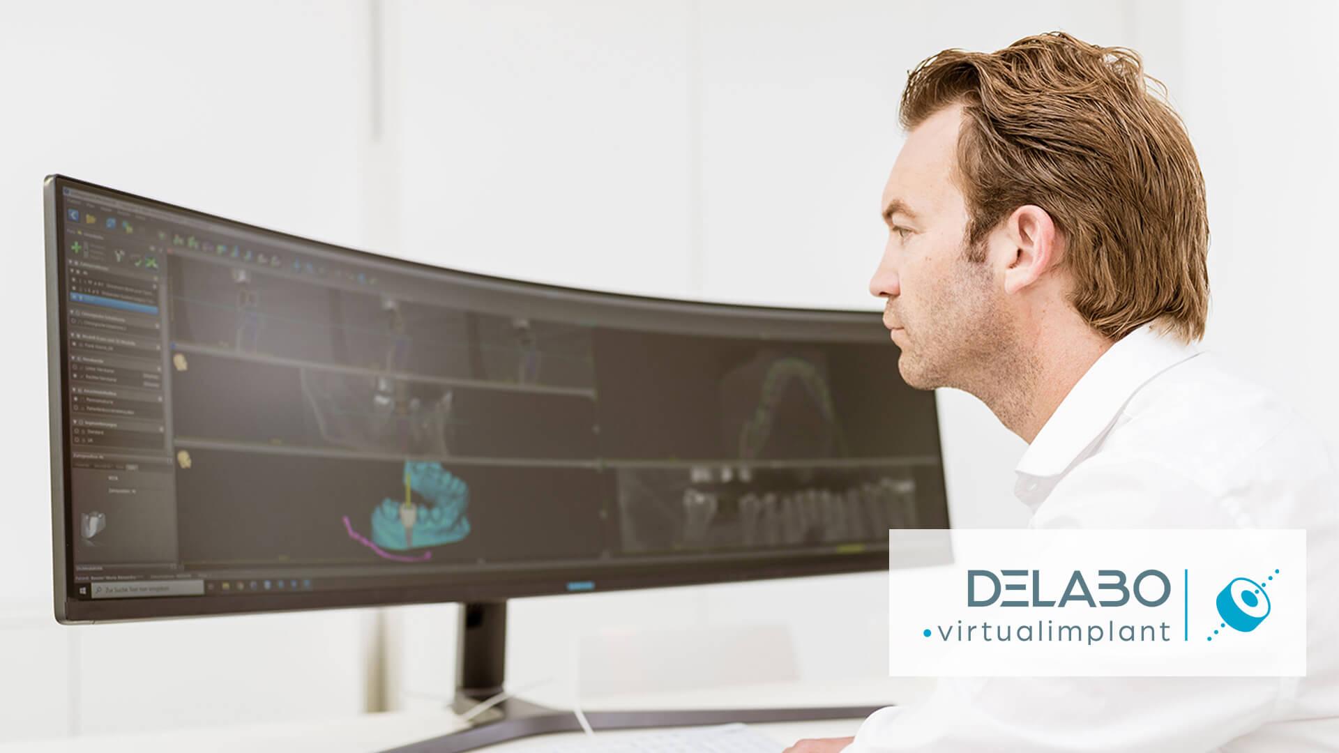 Product DELABO.virtualimplant – umfassender Service für perfekte Implantate - Hamm Dental Zahntechnik image
