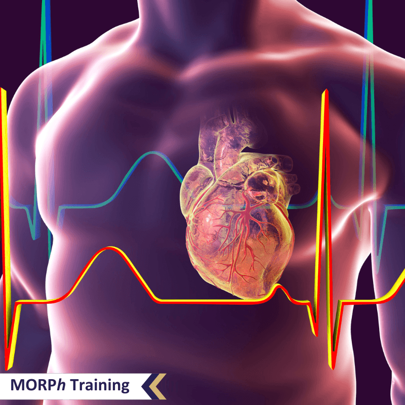 Product Heart Failure A Pharmacists Perspective - MORPh - Primary Care Training Association & Network image