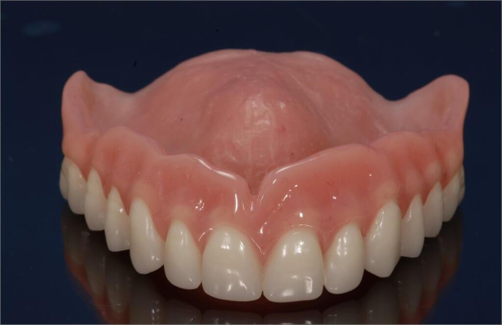 Product Dental Labs for Dentures in Arizona - Conventional Full and Partial Dentures image