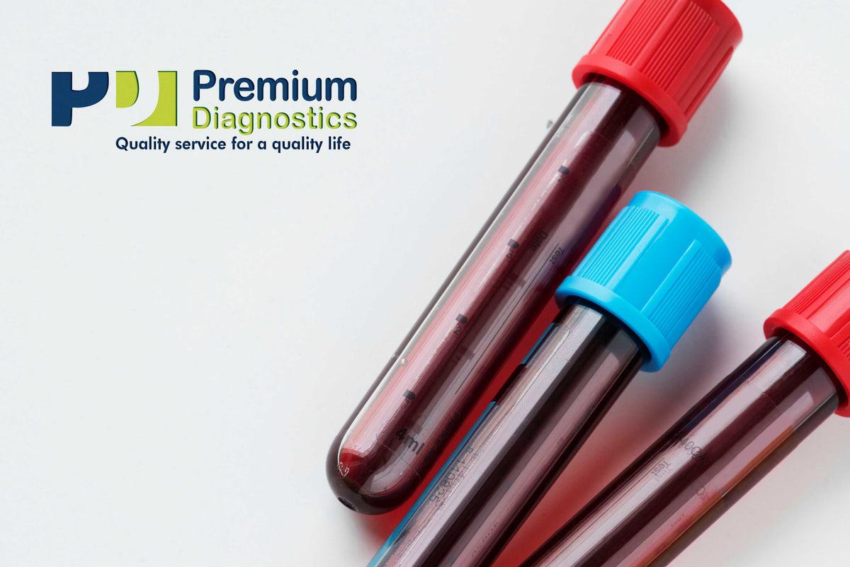 Image for Acylcarnitine, plasma — Premium Diagnostics & Clinics