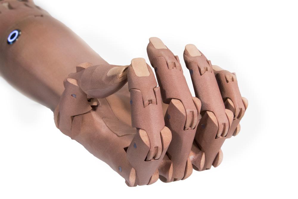 Not All 3D Printed Prosthetics Are Created Equal - Unlimited Tomorrow