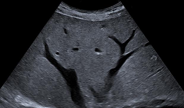 Product Abdominal Ultrasound - Insight Medical Imaging image