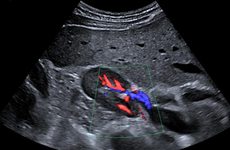 Product Renal Ultrasound - Insight Medical Imaging image