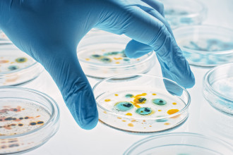 Eine Petrischale welche mit Bakterien gefüllt ist